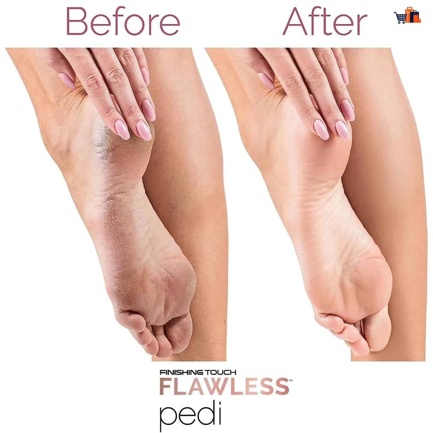 Electric Foot Callus Remover for Feet - Foot Scrubber